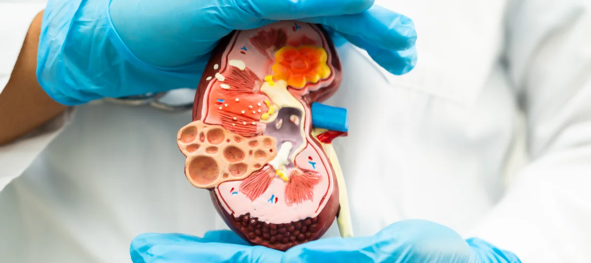 Transplate de riños